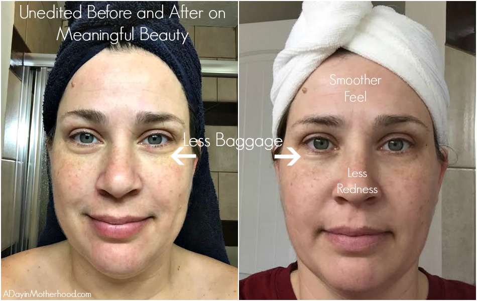 Meaningful Beauty Skincare: Is It Legit and Effective?