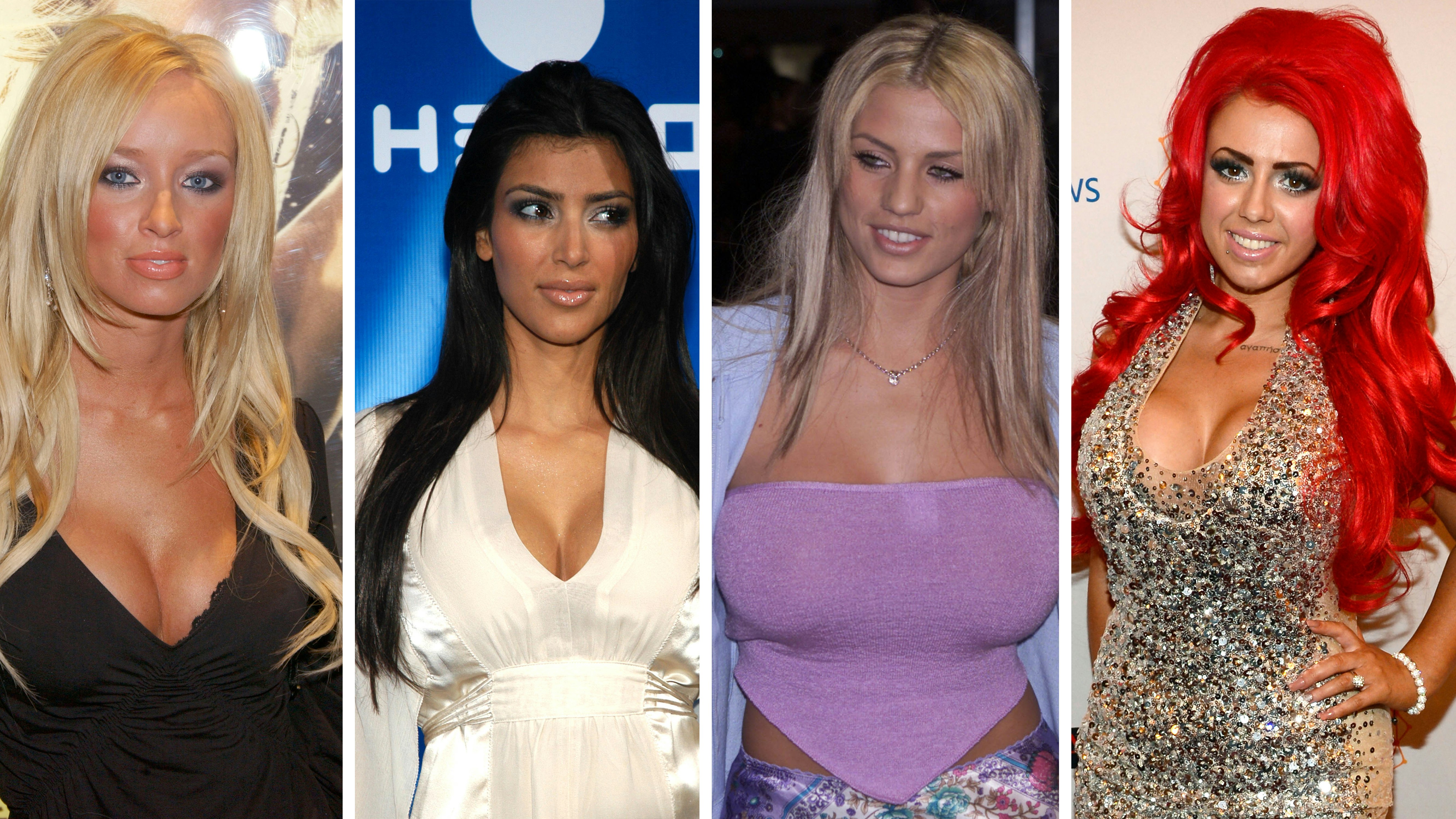 Celebrity Plastic Surgery Before After: Shocking Transformations You Wont Believe