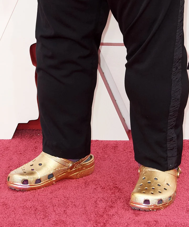 Gold Crocs for Every Occasion: From Casual to Dressy, See How to Wear Them.