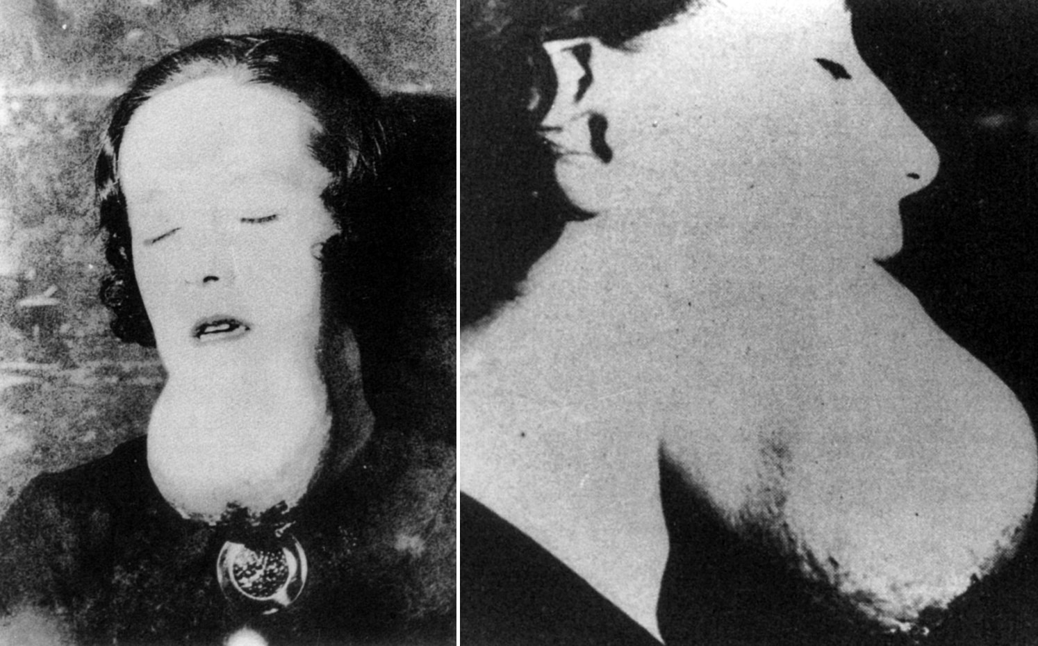 Unpacking the Grace Fryer Story: The Woman Who Took on the Radium Industry