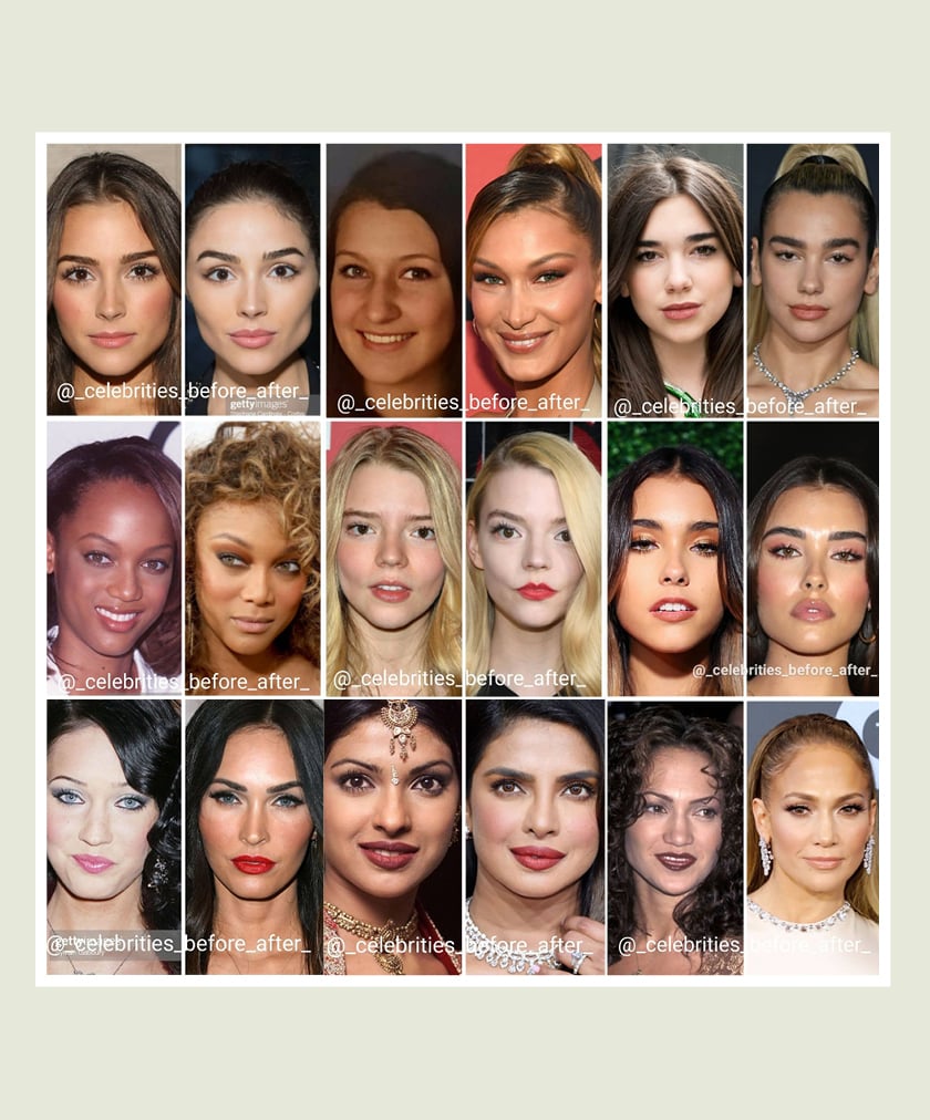 Celebrity Plastic Surgery Before After: Shocking Transformations You Wont Believe