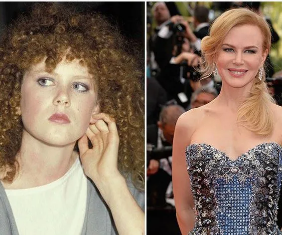 Nicole Kidman Younger: See Her Amazing Transformation!