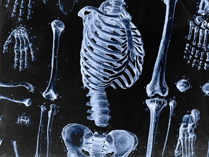 White skeleton problems: How to fix common issues!