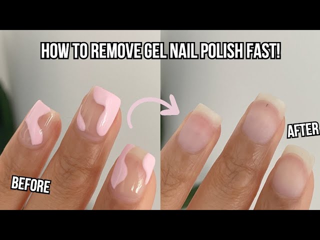 Gel Nail Polish Remover: Easy Ways to Remove Gel Nails at Home!